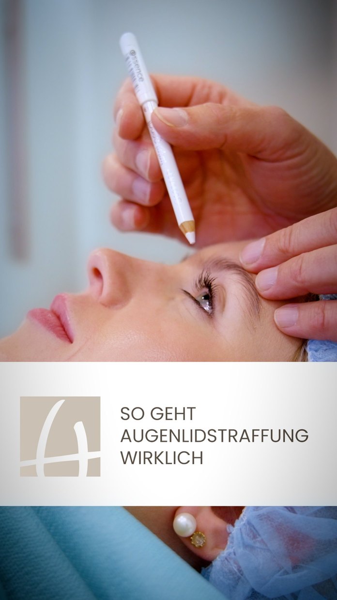 Standbild: So geht Augenlidstraffung wirklich
